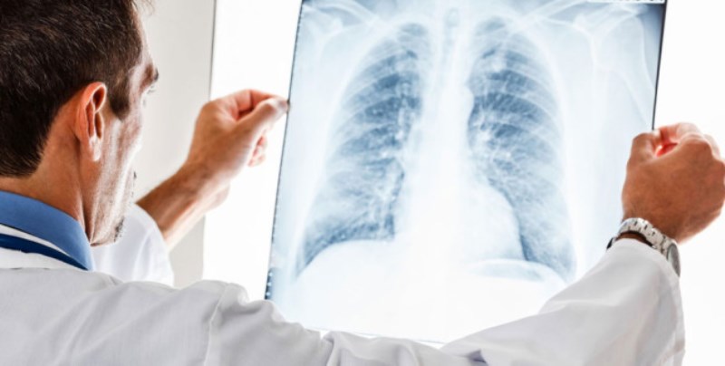 Қатерлі ісіктен қалай сақтандырамыз?