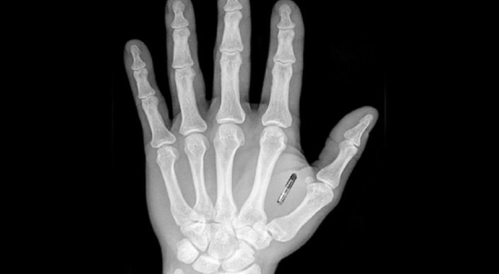 Әлемде компаниялар қызметкерлеріне микрочип ендіруде