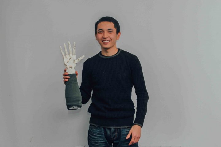 Жасанды интеллектке ие протез