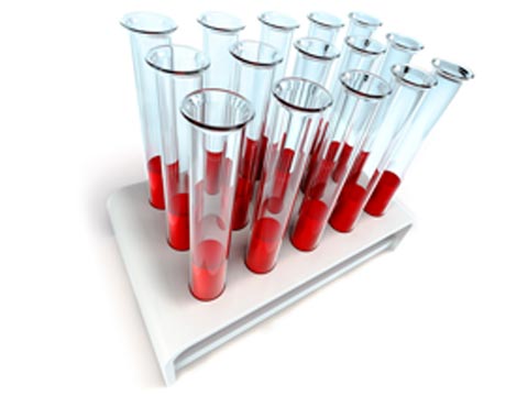 Қазақ­стан­да «гемофилия» диагнозы бар 1273 науқас есепте тұр