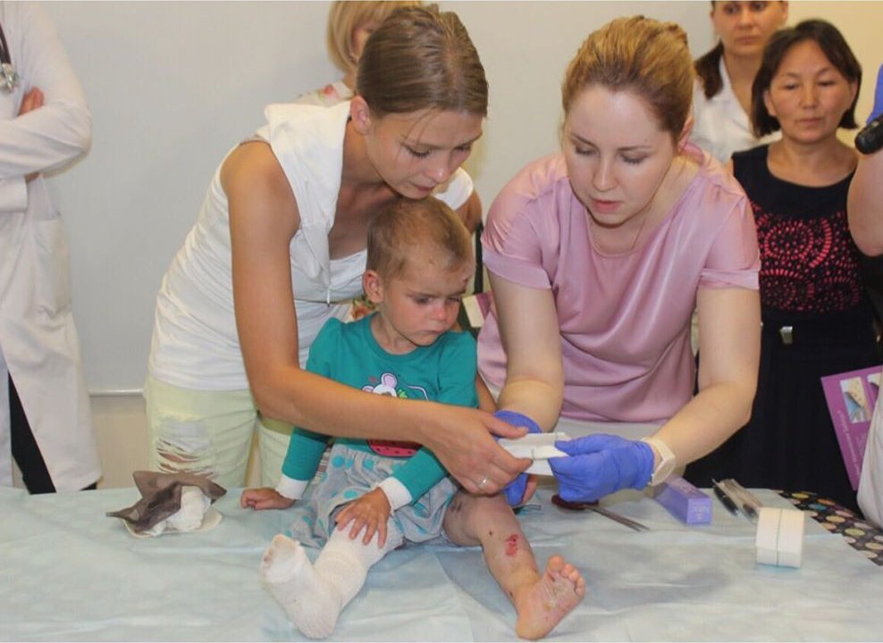 «Көбелек балаларды» емдеуге байланысты семинар өтті