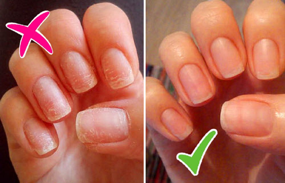 Гель-лактың қорқынышты қатері