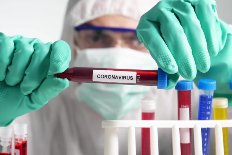Маңғыстауда тағы екі адамнан COVID-19 диагнозы анықталды