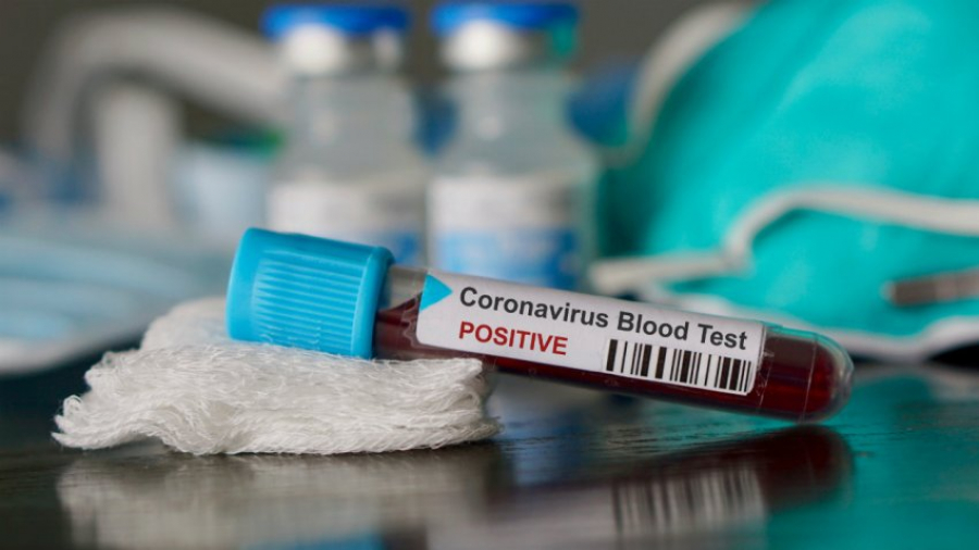 Маңғыстауда COVID-19 жұқтырған 5 науқас жансақтау бөлімінде жатыр