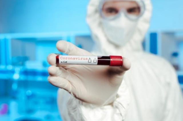 Соңғы тәулікте 143 адамнан вирус анықталды