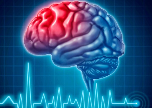 Инсульт бір-ақ күнде адамды дәрменсіз мүгедекке айналдыратын дерт