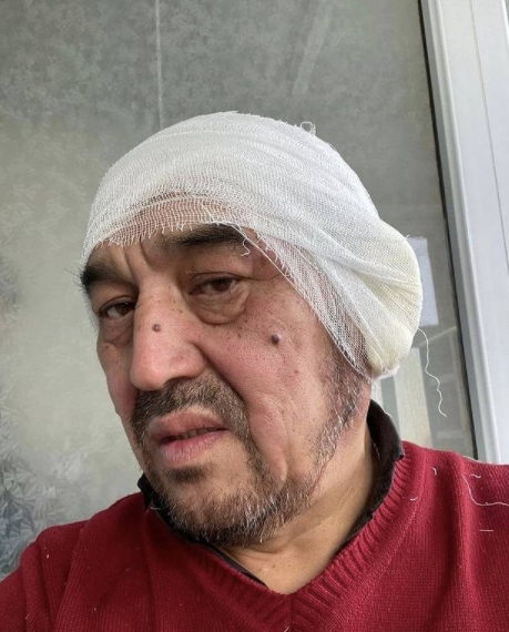 Қарағанды облысында құлағы үсіген ер адам ауруханаға түсті