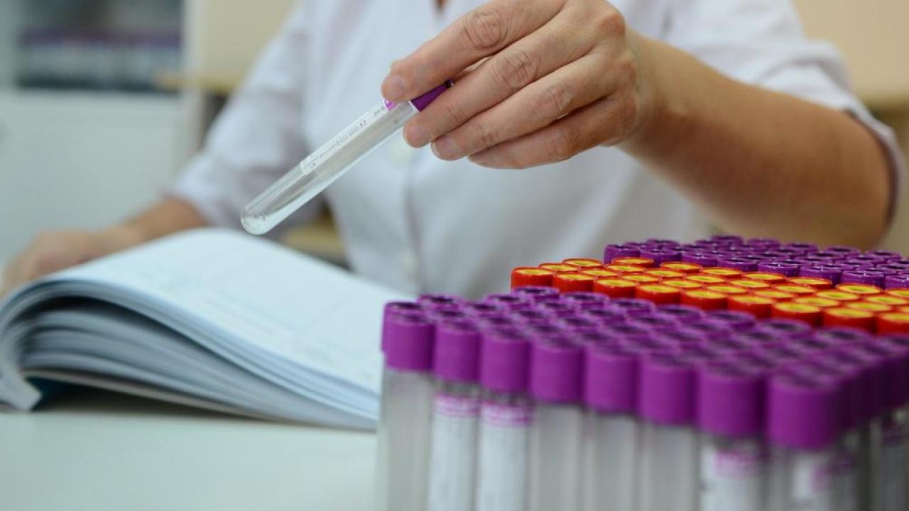 Атырауда барлығы 1,2 млн ПТР-тест өткізілген