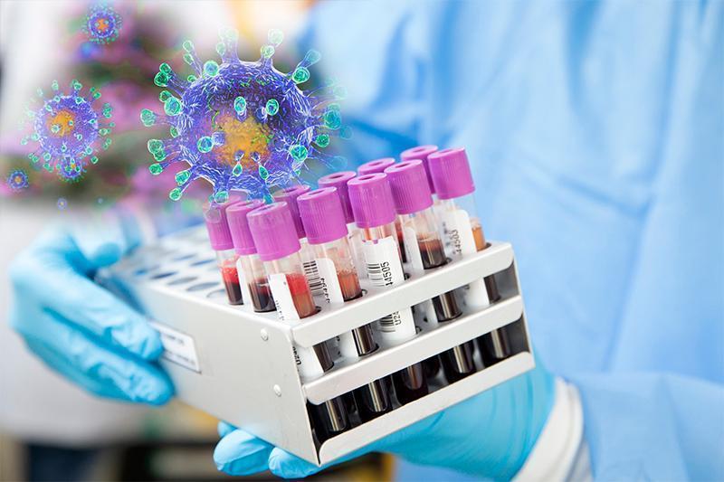 Өткен тәулікте Қазақстанда 1953 адамнан коронавирус анықталды