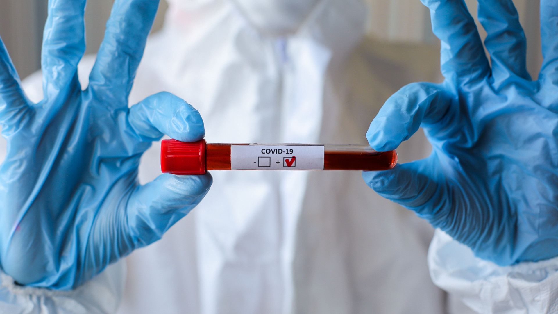 Соңғы тәулікте 1038 адам коронавирус инфекциясын жұқтырды