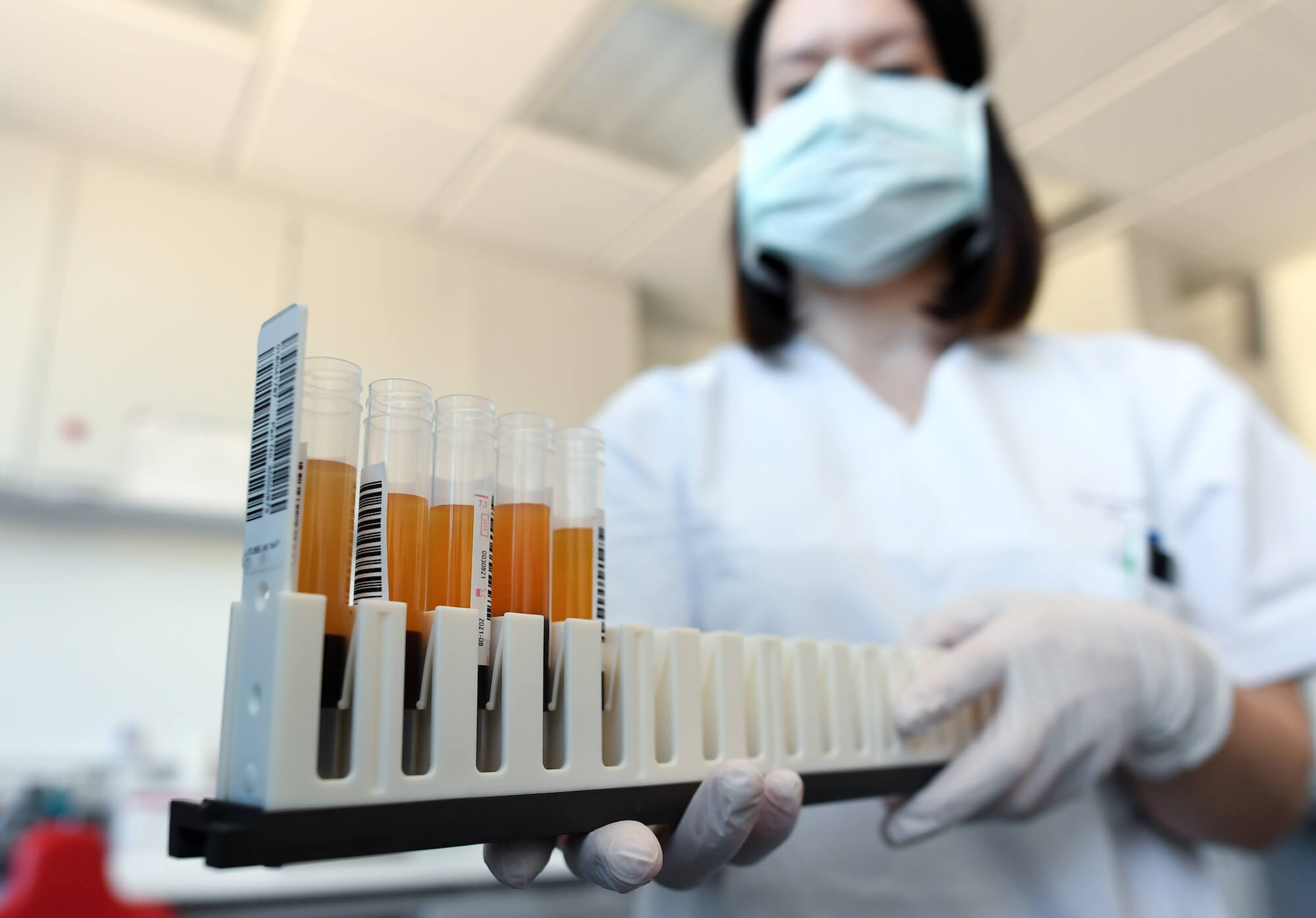 Қазақстанда өткен тәулікте 795 адамнан коронавирус анықталды