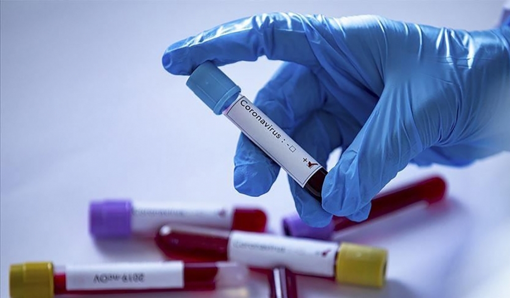 Өткен тәулікте 13 523 адамнан коронавирус инфекциясы анықталды