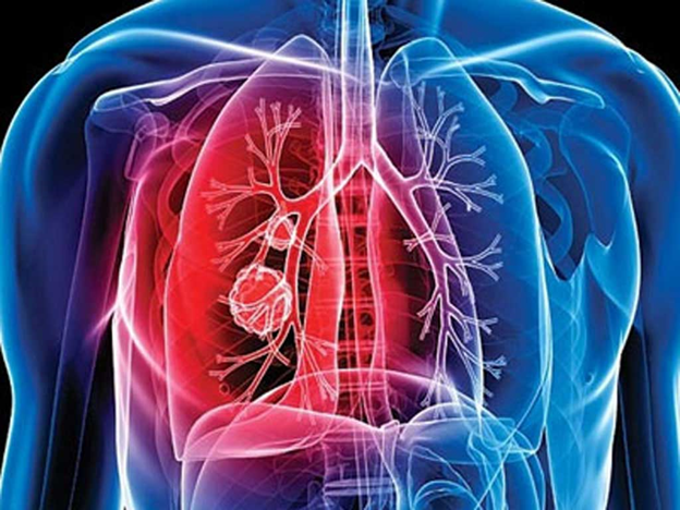 Туберкулезге шалдыққандар 2,3 есеге төмендеген