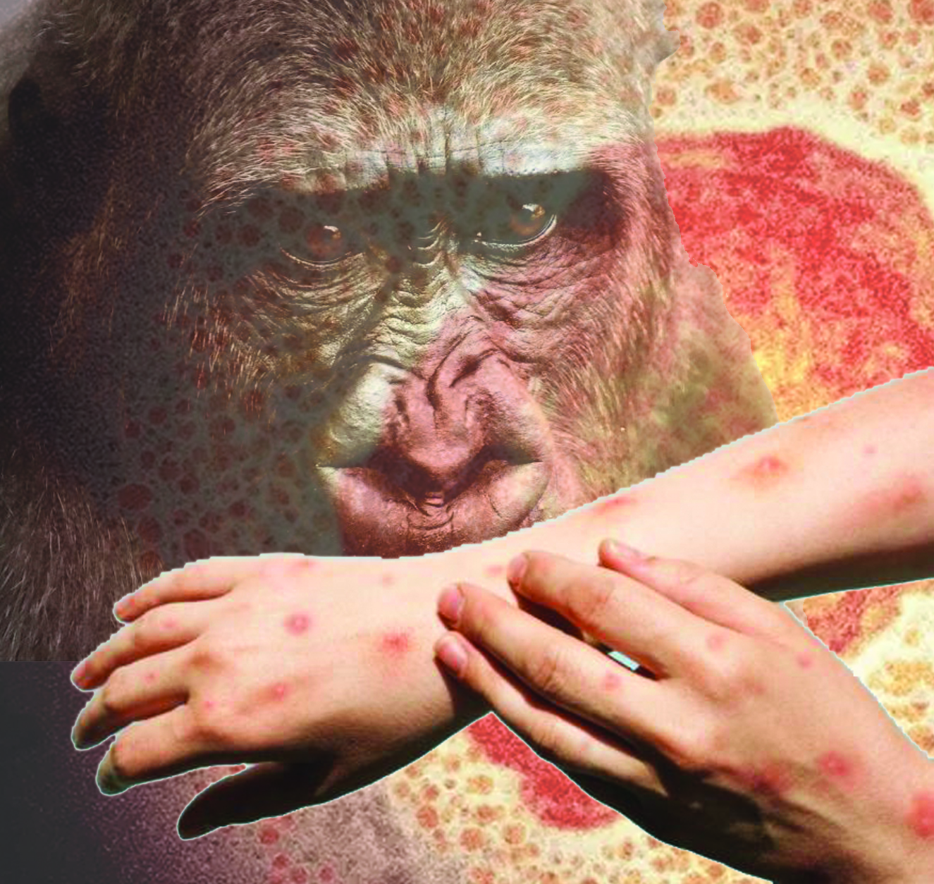 Әлемде маймыл шешегі  өршіп барады