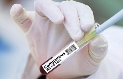 Елдегі коронавирус бойынша ахуал бақылауда - министрлік