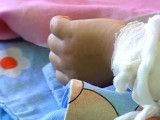 Қызылордадағы балабақшада бүлдіршін қайнаған суға күйіп қалды